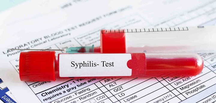 SANTÉ MATERNO-INFANTILE Syphilis maternelle : le dépistage gratuit étendu jusqu'en 2029